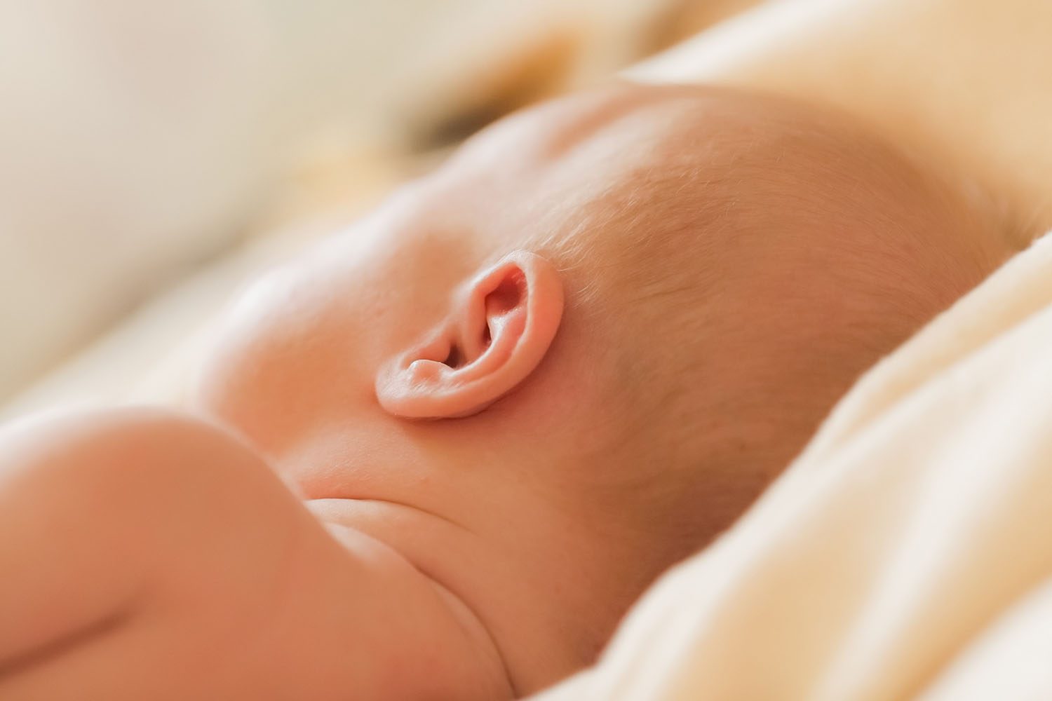 Exame de Ouvido Bera Boa Vista - Exame Bera em Bebê - Clínica Aura  Aparelhos e Próteses Auditivas